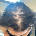 Alopecia Booking - Makeri Beauty